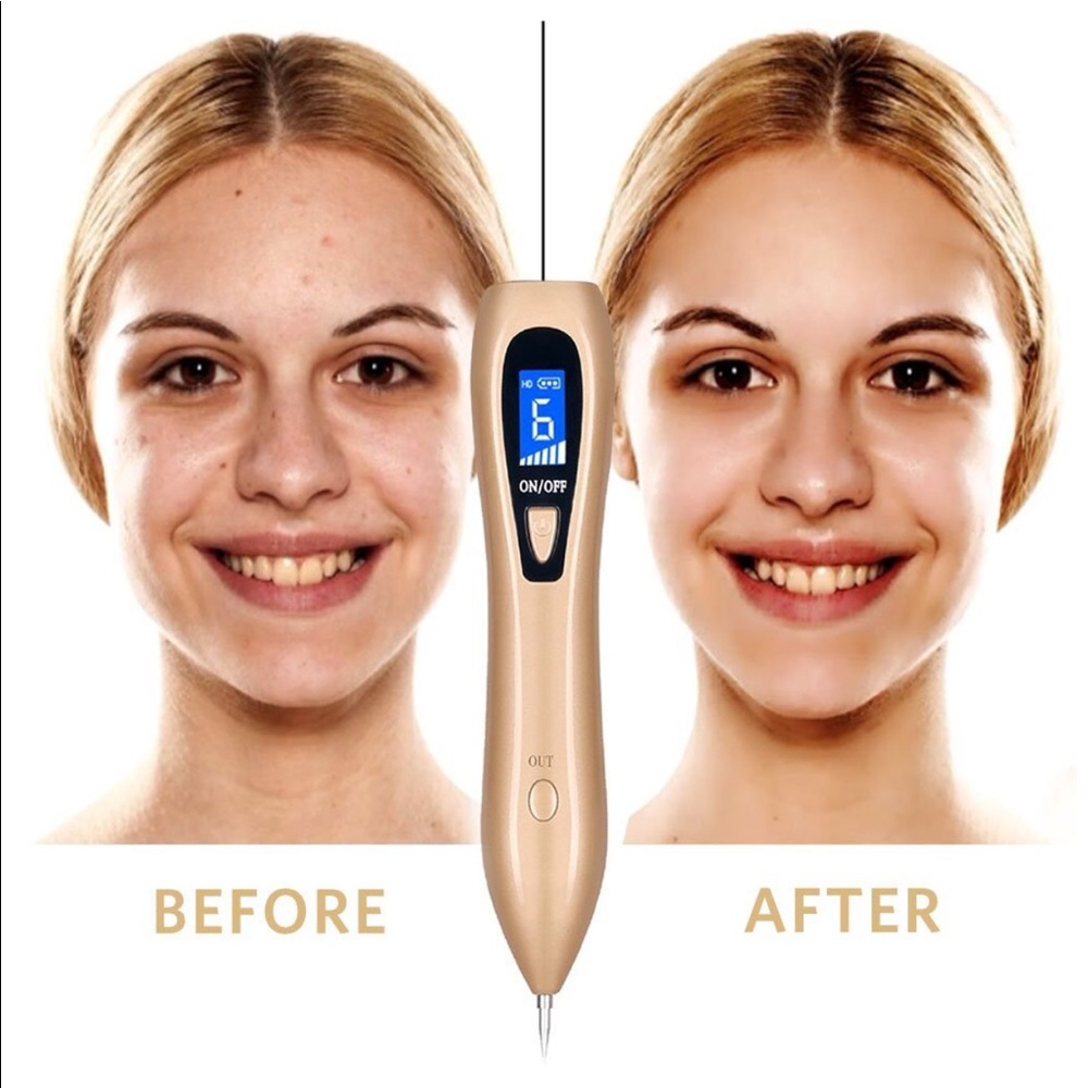 Brand new Mole Portable Rechargeable Remove pen